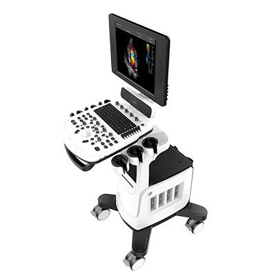 Varredor Chison Qbit 5 do ultrassom de Doppler da cor com o diodo emissor de luz de 15 polegadas