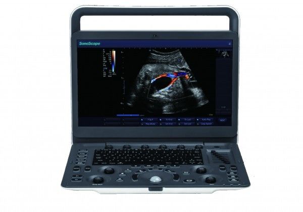 7 máquina portátil do ultrassom de SonoScape E3 dos níveis da imagem latente com o monitor de 15,6 polegadas