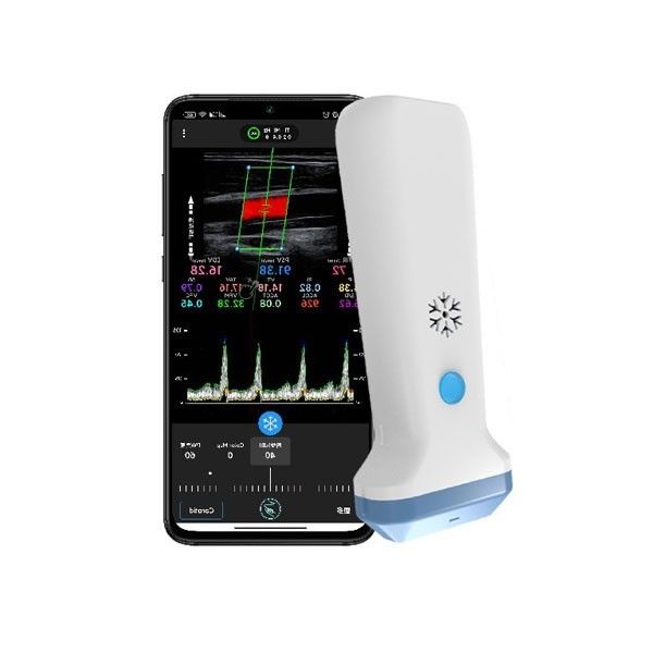 varredor portátil do ultrassom de Doppler da cor de 12.6cm para profissionais dos cuidados médicos