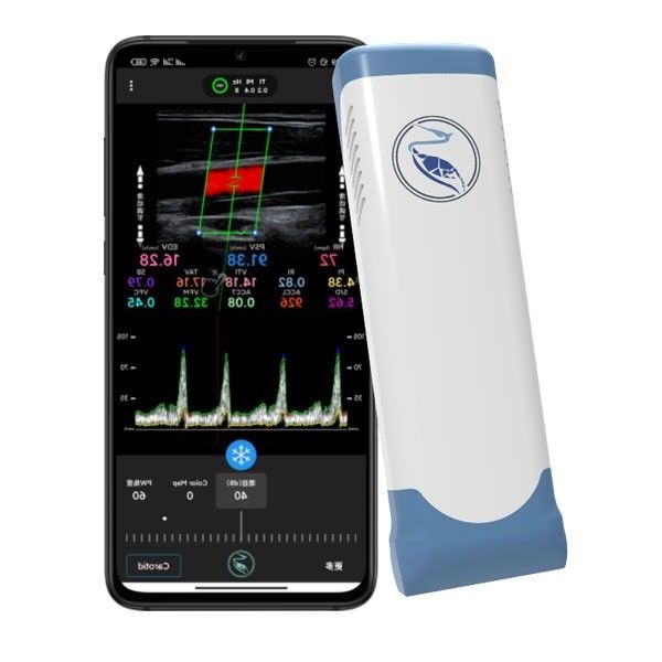 Quadros do varredor 100 do ultrassom de Echo Color Doppler Wireless Handheld