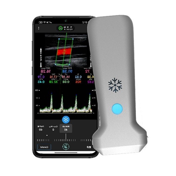 Scanner de ultrassom portátil linear sem fio certificado pela CE | Sonda portátil de ultrassom Doppler colorido de 8,3 MHz