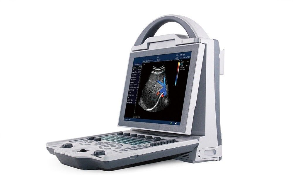 Sistema do ultrassom de Doppler da cor do portátil do nível básico 16GB 2D para a gravidez