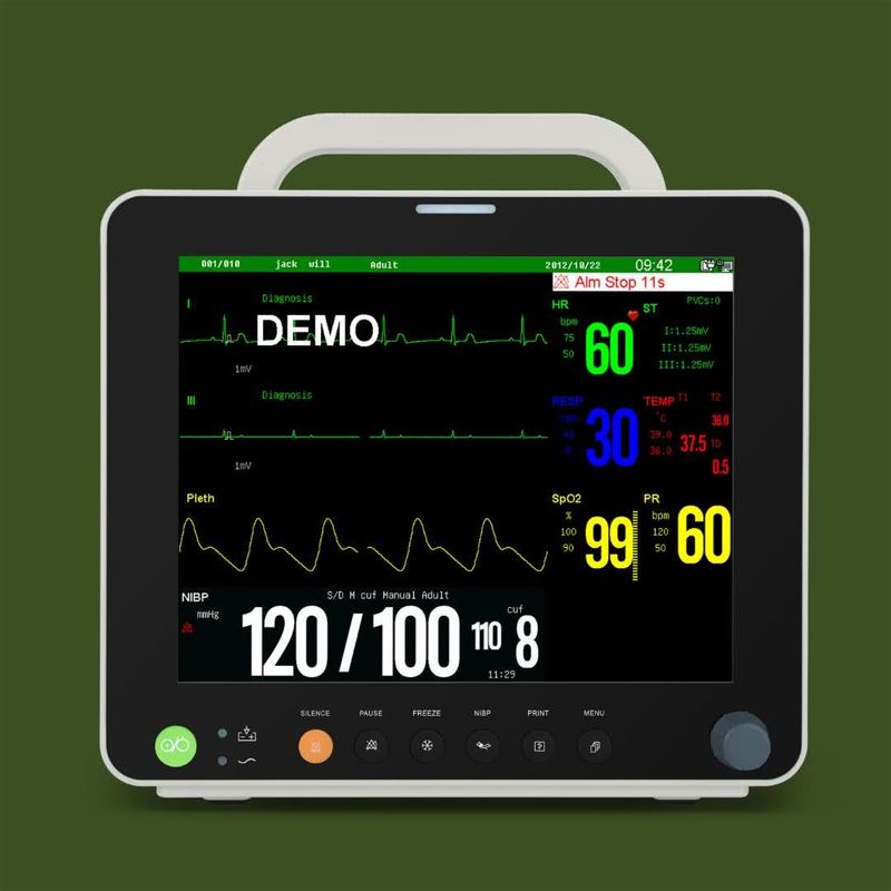 12,1 da” monitores pacientes do multi parâmetro veterinário da exposição de TFT cor com ECG