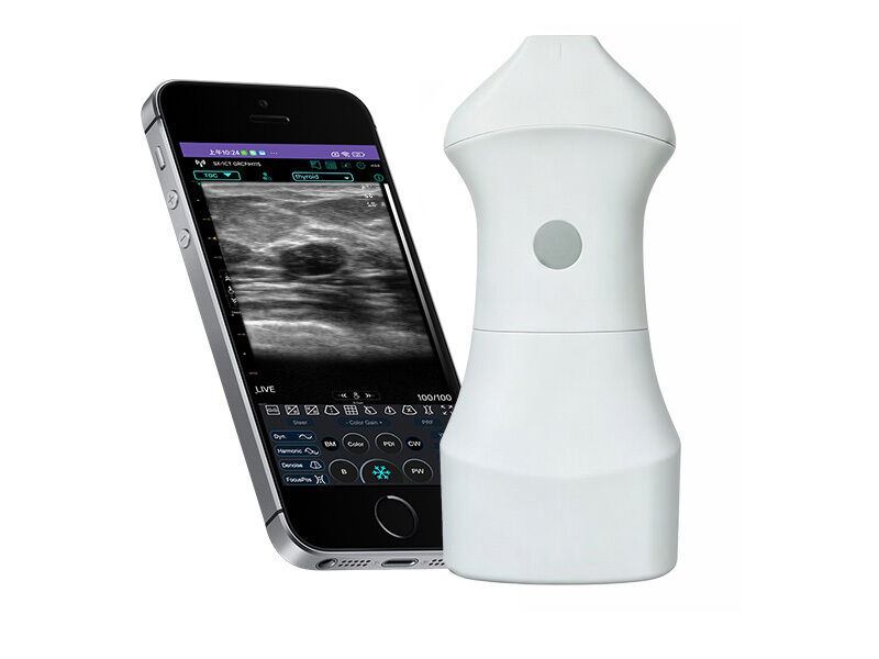 Sonda de ultrassom de pele de alta frequência de 24 MHz para medicina estética, dermatologia e orientação de procedimentos injetáveis