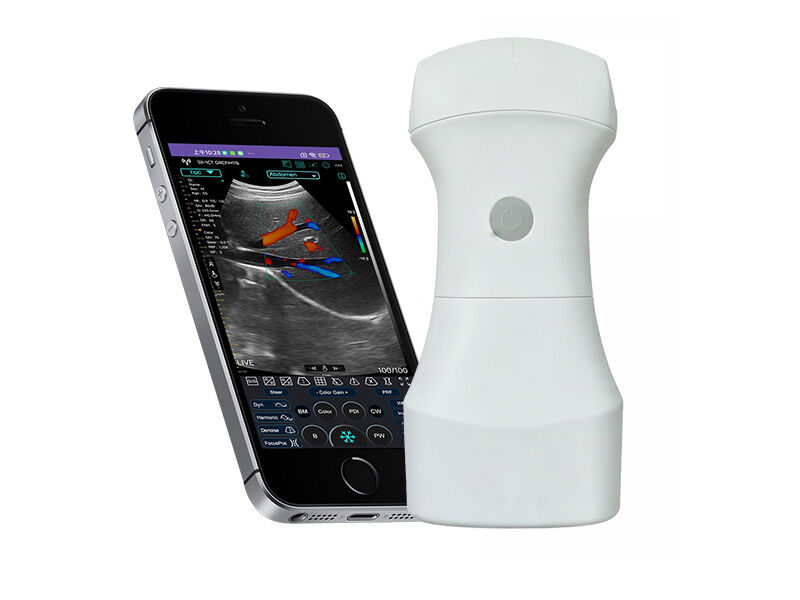 Scanner de ultrassom convexo de bolso sem fio com bateria substituível para imagens clínicas portáteis